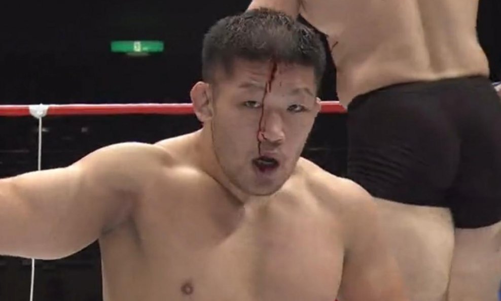 Satoshi Ishii razbijeno čelo