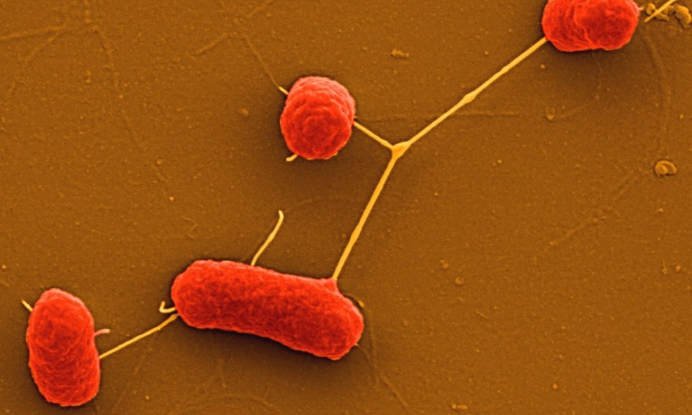 Smrtonosna bakterija Escherichia coli enterohemoragijskog soja (2)