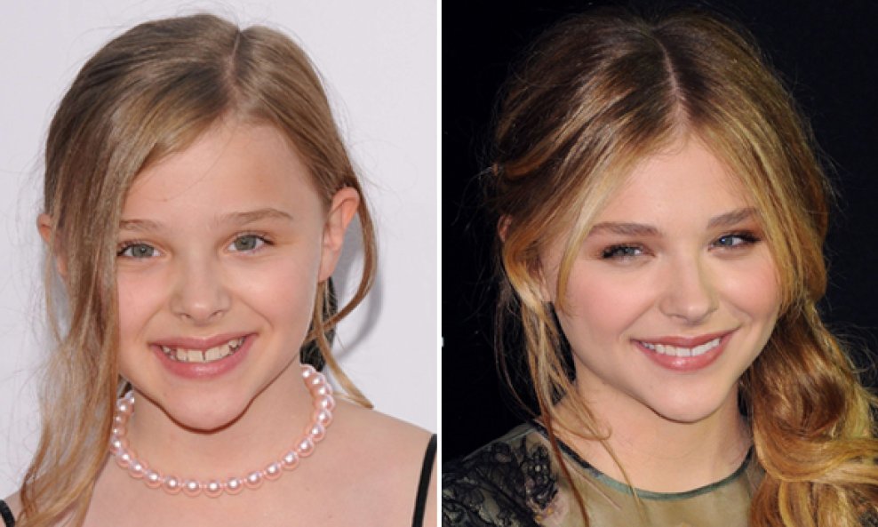 Chloe Grace Moretz nekad i sad