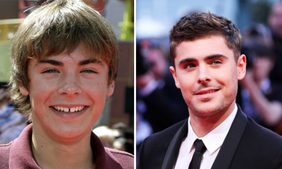 Zac Efron nekad i sad