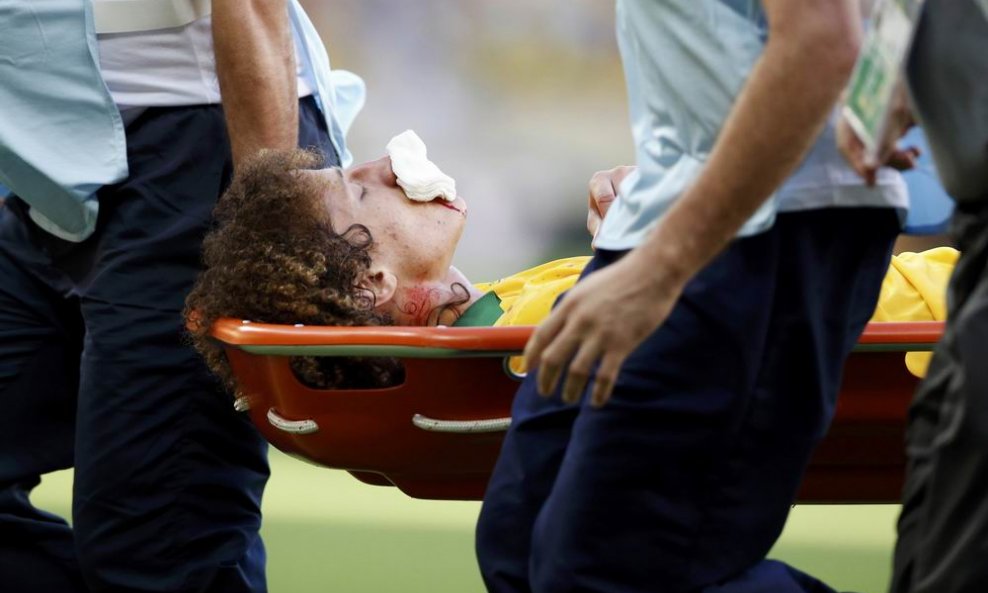 David Luiz na nosilima i slomljena nosa