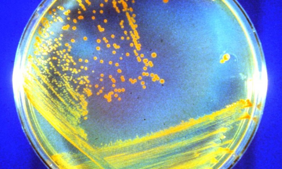 Deinococcus radiodurans bakterija