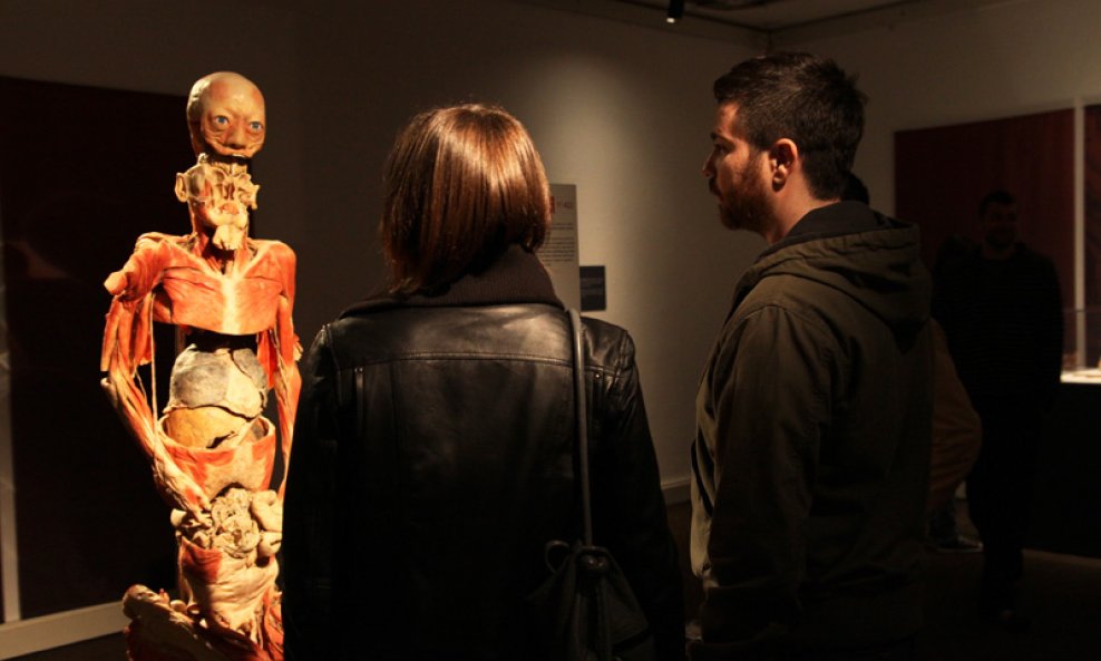 Bodies Revealed - Otvaranje Izložbe (4)