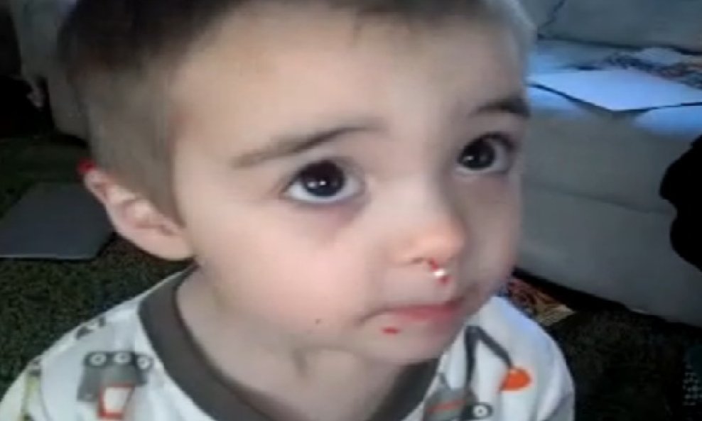klinac s mrvicama po licu funvideo