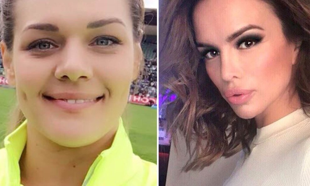 Sandra Perković, Severina