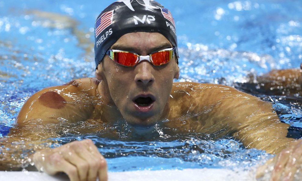 Michael Phelps Rio OI cupping