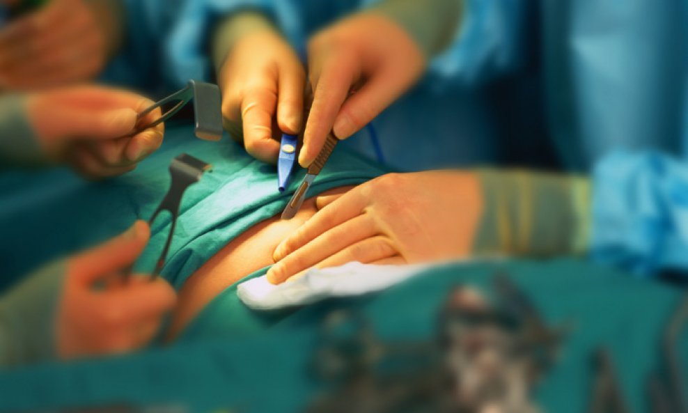 operacija bolnica kirurzi