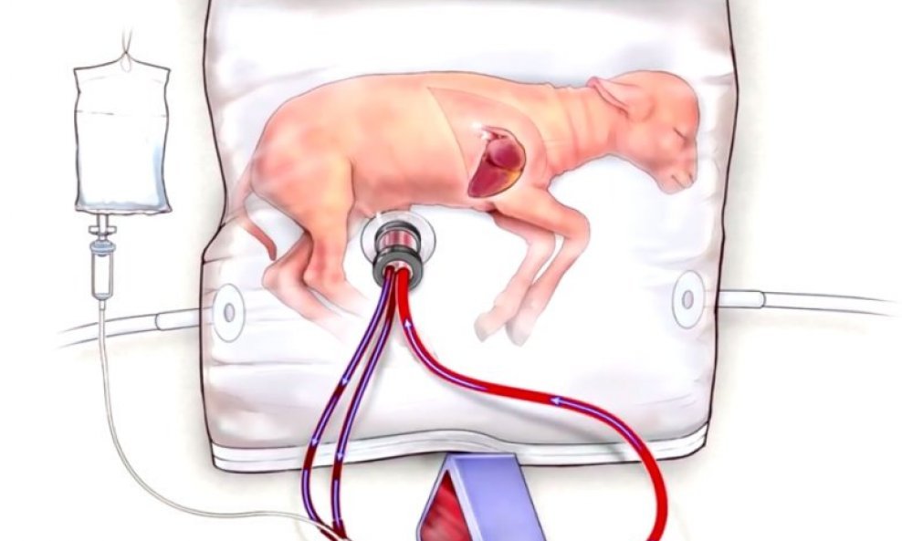Umjetna maternica (ilustracija)