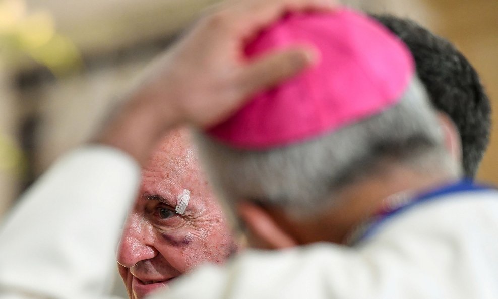 Papa Franjo s ozlijedom oka iz Kolumbije primio je na dar kravu Lou