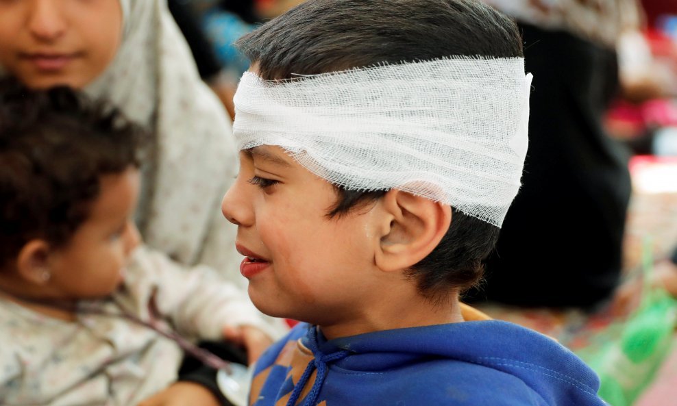 Ranjeni dječak u Siriji