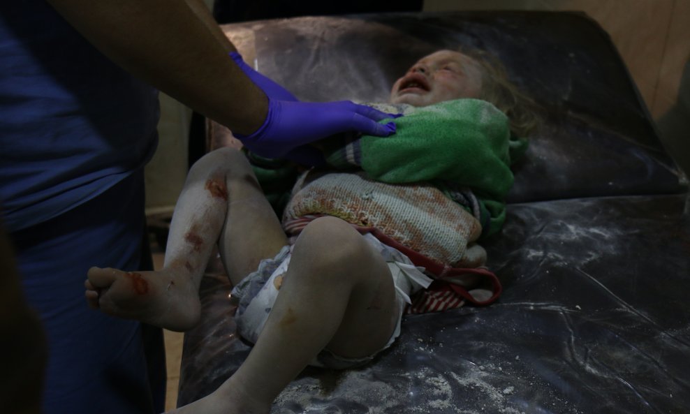 Liječnici u poljskoj bolnici pružaju pomoć djetetu ozlijeđenom u zračnim napadima na sjevernosirijsku pokrajinu Idlib 4. veljače 2018.