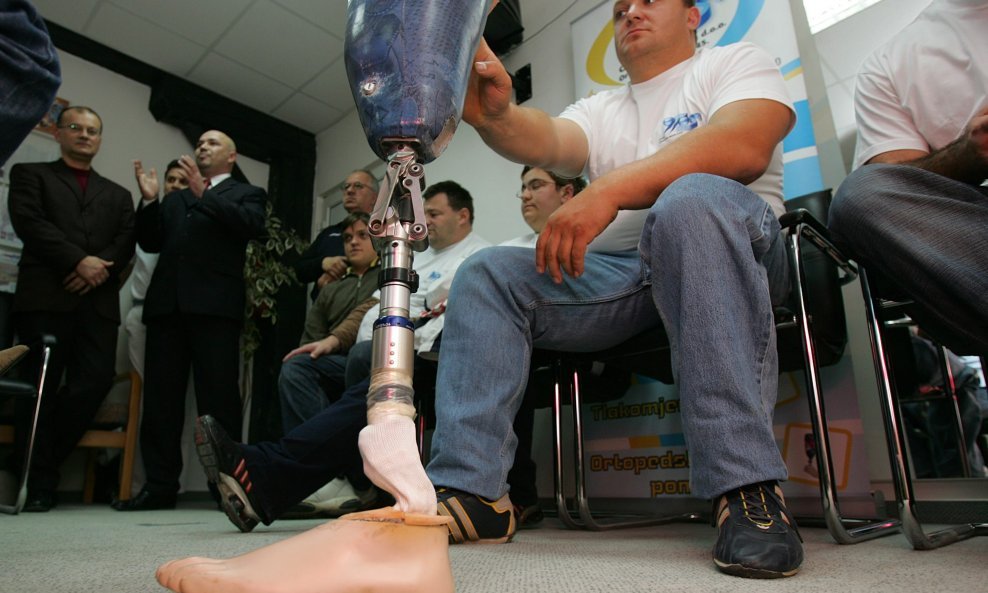 Tvrtka 'Otos Ortopedska tehnika' izrađuje najmodernije proteze i za članove Paraolimpijske reprezentacije