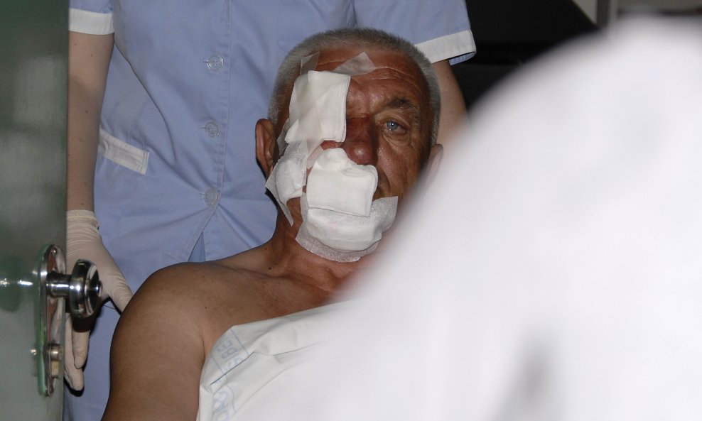 Stanko Kosor, ozlijeđen u eksploziji u Šibeniku