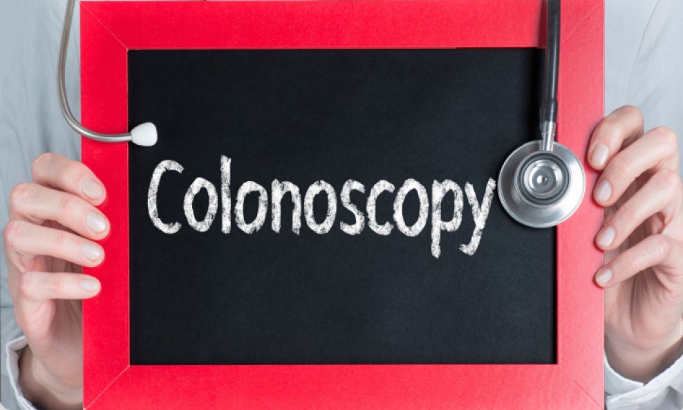kolonoskopija