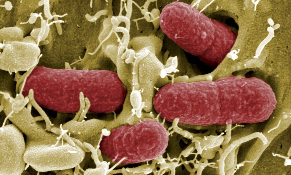 Smrtonosna bakterija Escherichia coli enterohemoragijskog soja (4)