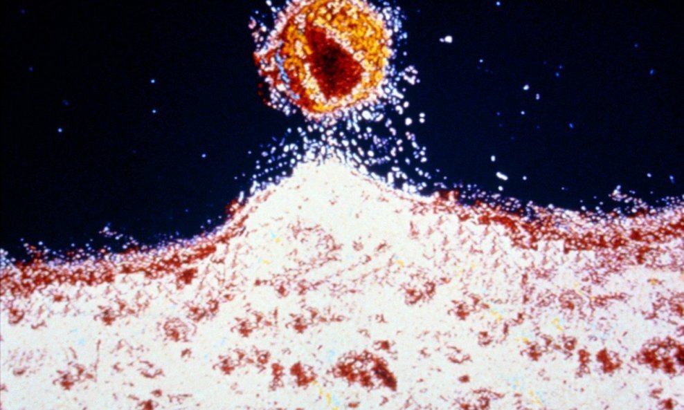 Virus HIV-a