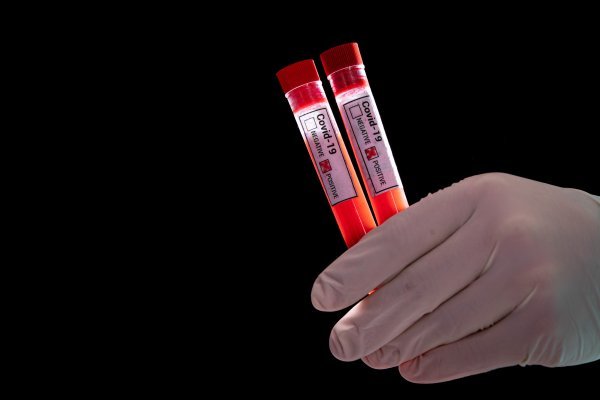 Koronavirus epruvete krv