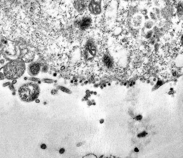 Brazilski znanstvenici snimili su trenutak u kojem koronavirus ulazi u stanicu