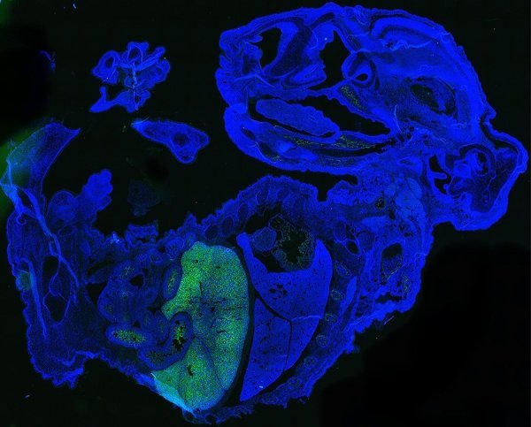 Ljudske stanice, označene zelenom bojom, u 17-dnevnom mišjem embriju, označenom plavom bojom. Većina ljudskih stanica su crvena krvna zrnca koja se nakupljaju u jetri fetusa