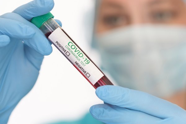 Prijavljivanje slučajeva koronavirusa drastično varira u cijelom svijetu