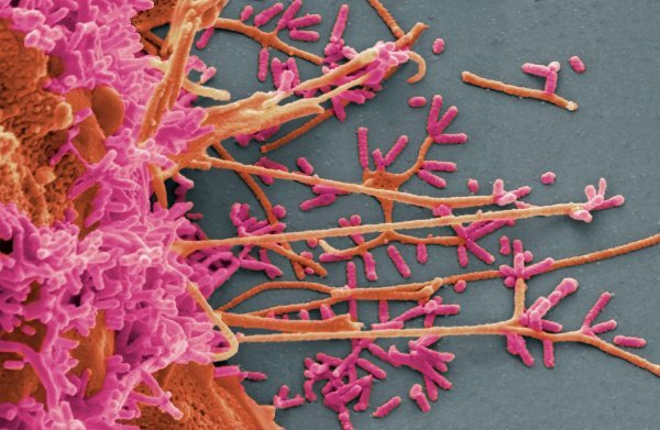 Ljudske stanice zaražene virusom gripe, vidljive elektronskom mikrografijom