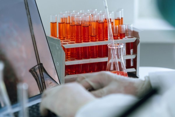 laboratorij, istraživanje, znanstvenici, cjepivo