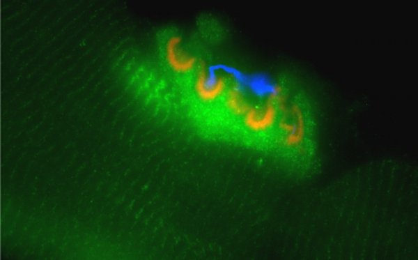 Mišićna biopsija: Laserska konfokalna slika telećeg mišića