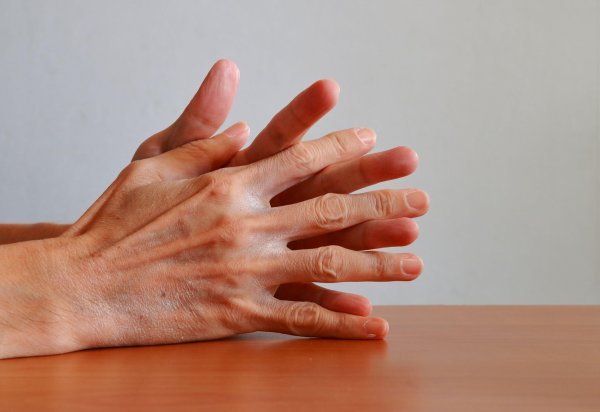 Promjene na koži uočene su i kod ljudi koji su, u strahu od zarake, pretjerano prali ruke sapunima i sredstvima za dezinfekciju
