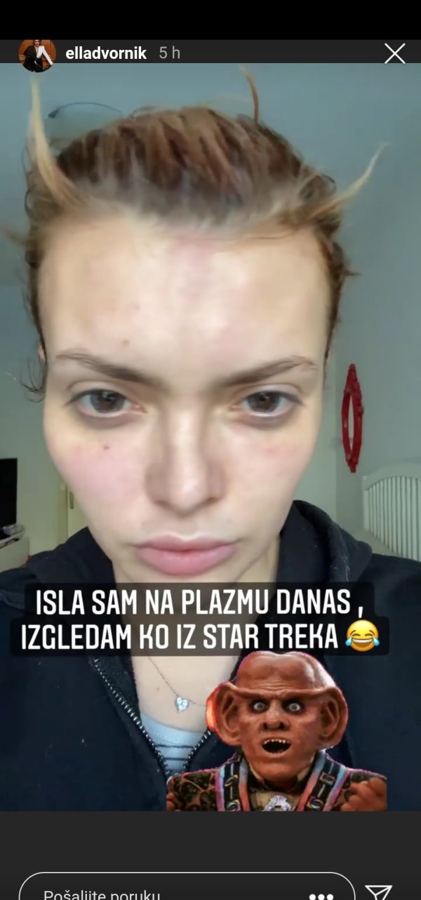 Ella Dvornik - tretman plazmom