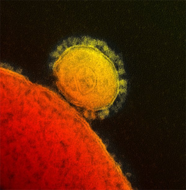 Virus MERS