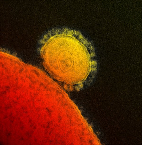 Virus MERS