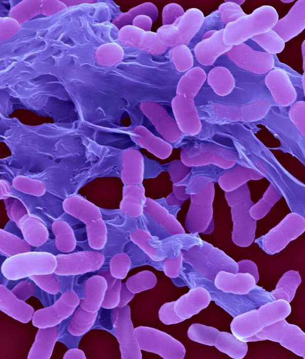 Acinetobacter baumannii