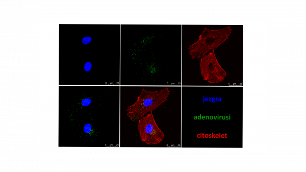 Slika ulaska adenovirusa tip 26 u stanice epitela čovjeka, a na konfokalnom mikroskopu snimio ju je dr.sc. Davor Nestić