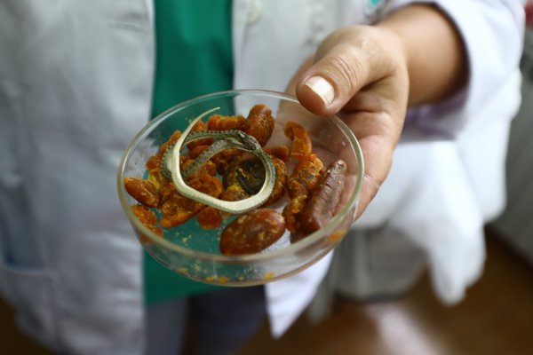 Beroš posjetio lokaciju buduće tvornice Imunološkog zavoda