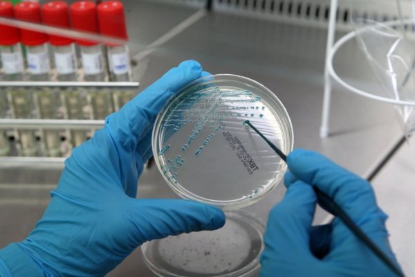 E.coli