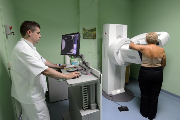 Odaziv na mamogarafiju je visokih 70 posto, ali cilj je još viši