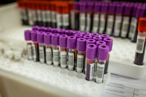 Apel sa zavoda: Zalihe sve manje, evo gdje možete darovati krv