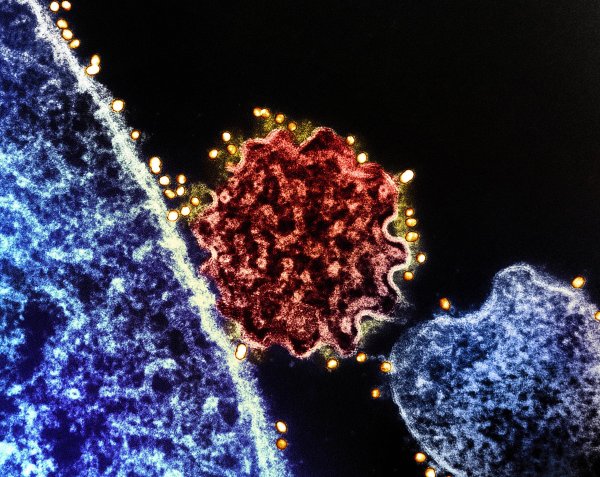 Za virus Nipah nema cjepiva ni lijeka