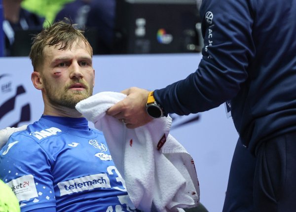 Rana na licu Davida Mandića