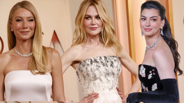 Analiza lica slavnih žena: Toksični trend u kojem estetski zahvati služe kao jeftina zabava