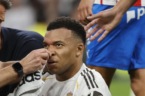 Mbappe objavio fotografiju glave: Pogledajte ozljedu za koju nije dobio penal