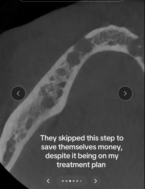 Posljedice stomatološkog rada u Turskoj