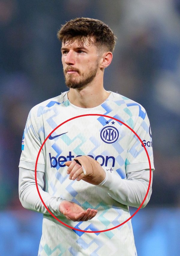 U Interu su mjesecima skrivali tešku ozljedu Petra Sučića: 'Bojali smo se...'