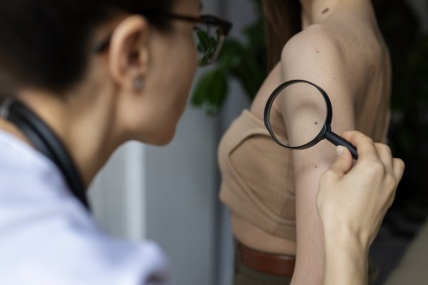 Rijetki su doista svjesni koliko je važno svakodnevno nanositi zaštitni faktor (SPF), neovisno o godišnjem dobu
