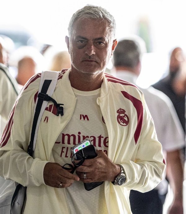 Jose Mourinho šokirao izgledom: Velika modrica ispod oka zabrinula je sve