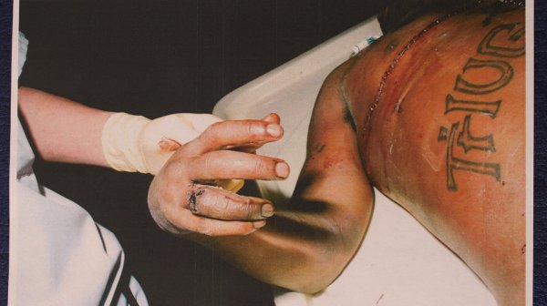 Dosad neobjavljena fotografija Tupacovih ozljeda nakon kobne pucnjave '96.