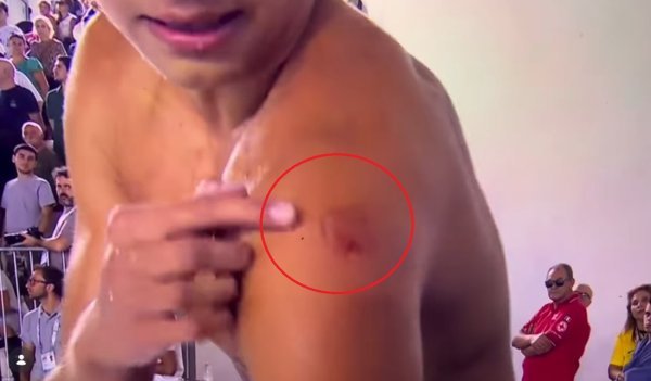 Vaterpolo dobio svog Luisa Suareza: Talijan ugrizao Crnogorca, pogledajte trag na ramenu
