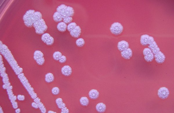 Burkholderia pseudomallei Gavin Koh / Wikimedia Commons