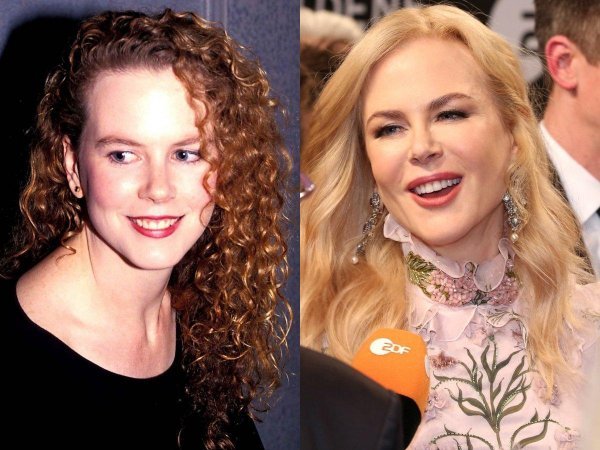 Nicole Kidman