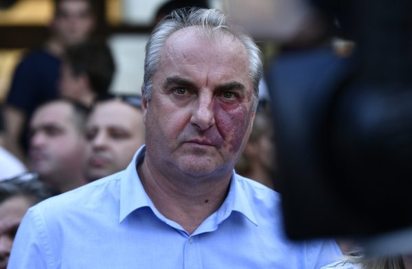 Roditelji izvrijeđali Bandića